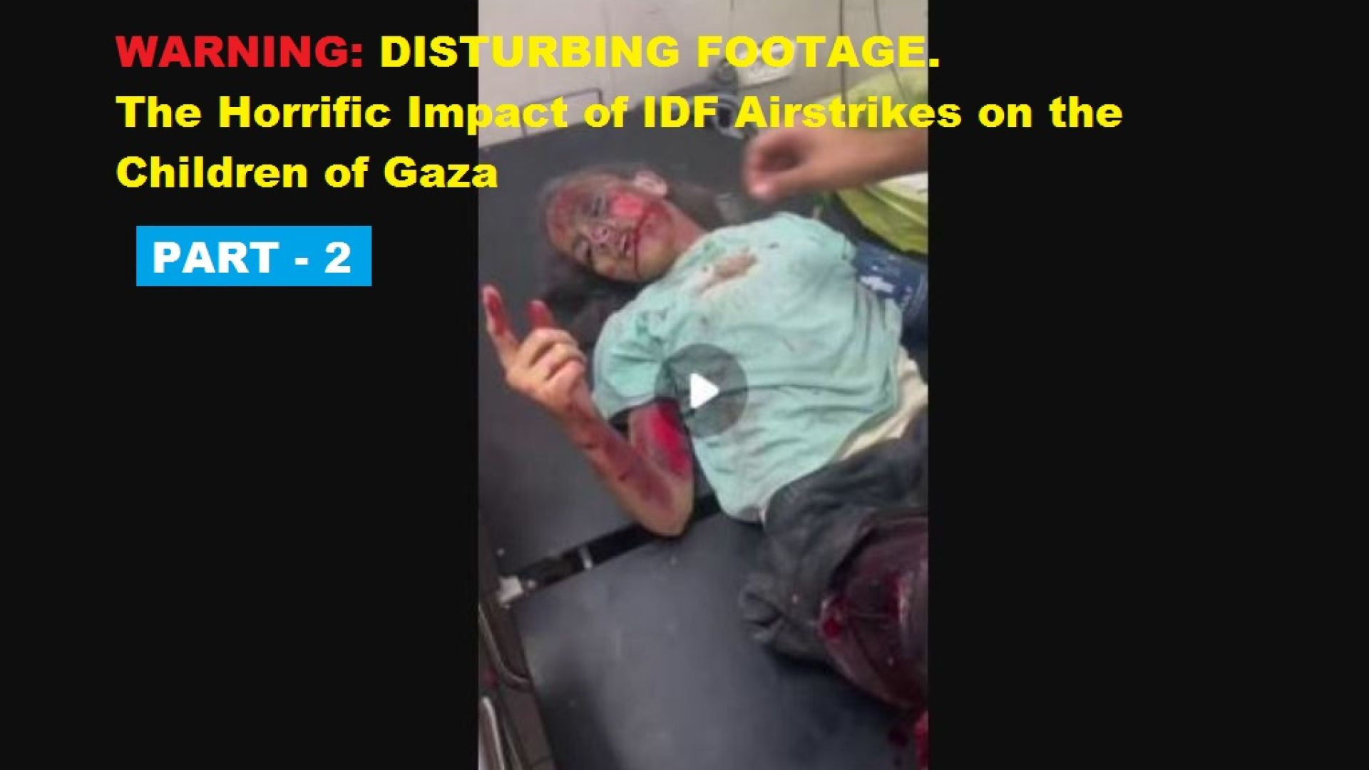 ⁣WARNING: DISTURBING FOOTAGE. The Horrific Impact of IDF Airstrikes on the Children of Gaza - Part 2