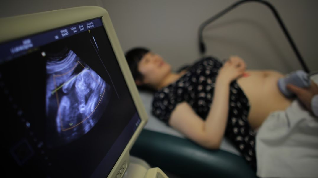 ⁣This Ultrasound of a Baby Struggling in Agony to Resist the Pincers of an Abortionist is Perhaps the