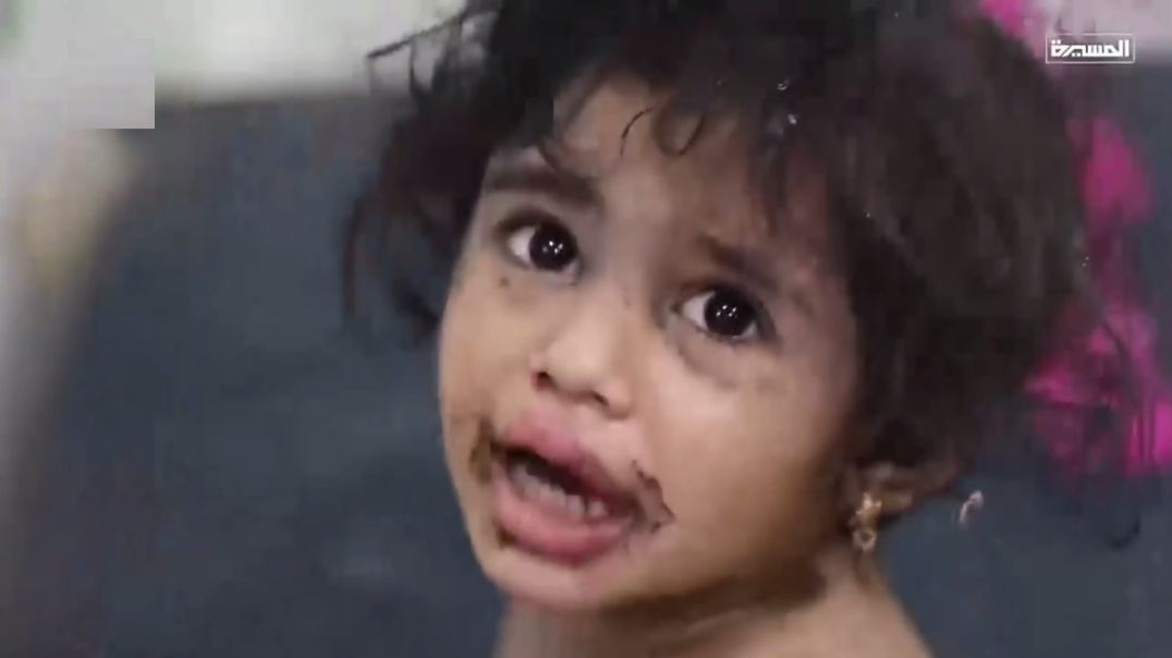 ⁣WATCH: Aftermath of US Attack on Yemen