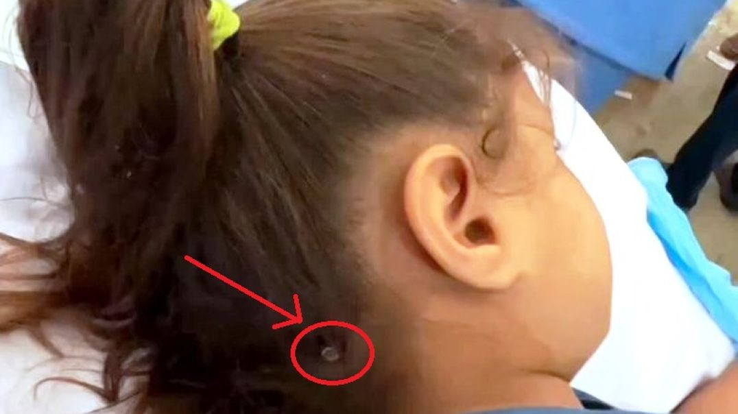 ⁣Bullet Pierces Child's Head, She Miraculously Survives